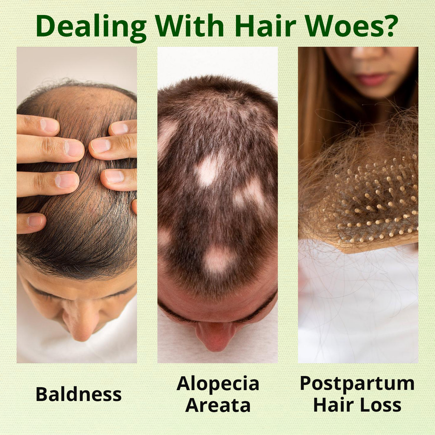 ⓒⓥⓡⓔⓞⓩ® Nourish & Flourish Hair Growth Spray