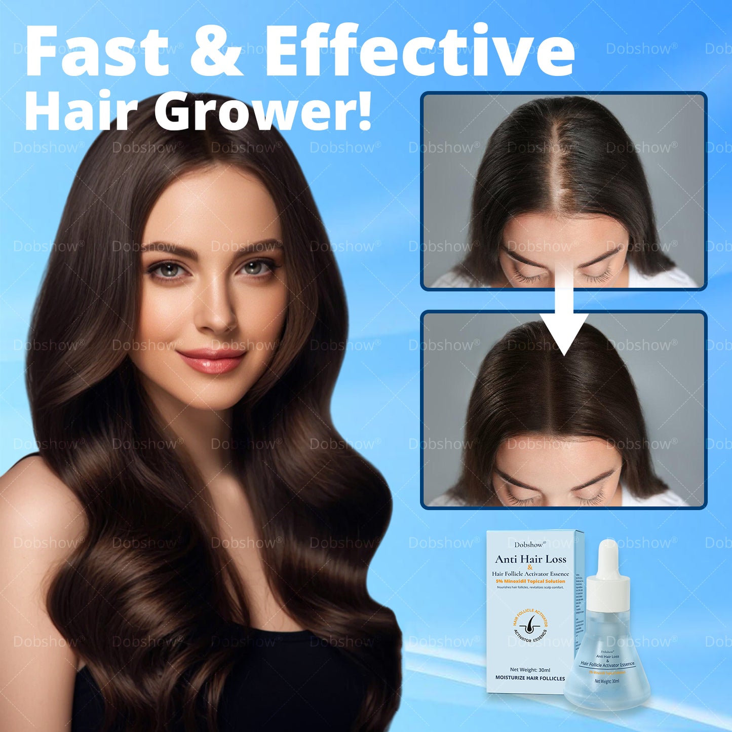 Ⓓⓞⓑⓢⓗⓞⓦ ® Anti Hair Loss & Hair Follicle Activator Essence