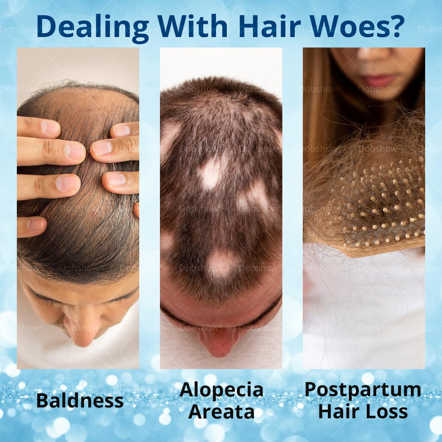 Ⓓⓞⓑⓢⓗⓞⓦ ® Anti Hair Loss & Hair Follicle Activator Essence