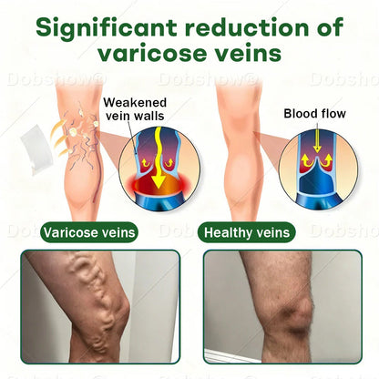 🎅 𝘾𝙝𝙧𝙞𝙨𝙩𝙢𝙖𝙨 𝙎𝙖𝙡𝙚 | Croaie® VeinLock Microneedle Patch
