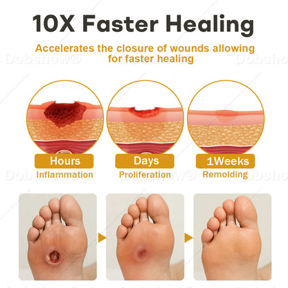 🔥#1 Best-Selling Wound Care Spray🔥Healrize® GlucoShield Bee Venom Wound Spray– Advanced Clinical Support for Diabetic Skin & Slow-Healing Wounds