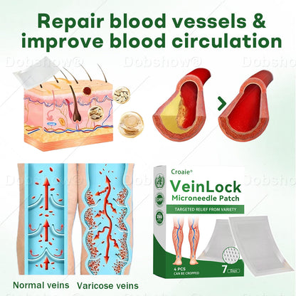 🎅 𝘾𝙝𝙧𝙞𝙨𝙩𝙢𝙖𝙨 𝙎𝙖𝙡𝙚 | Croaie® VeinLock Microneedle Patch