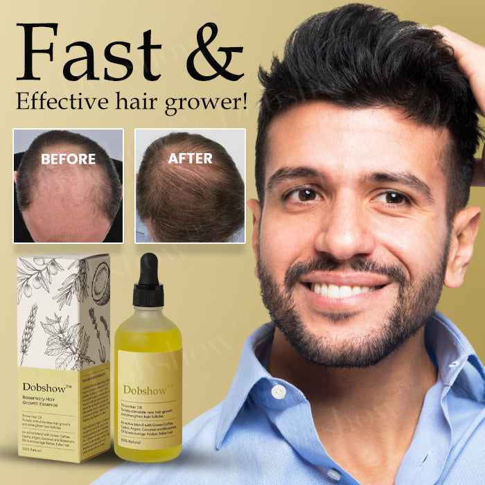 Dobshow® Rosemary Hair Growth Essence