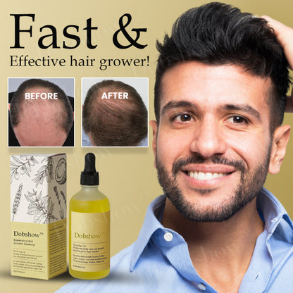 Dobshow® Rosemary Hair Growth Essence