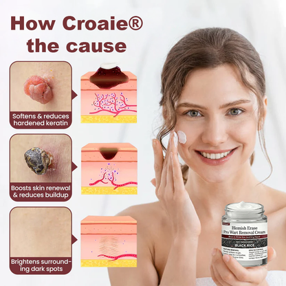 Croaie® Blemish Erase Pro Wart Removal Cream