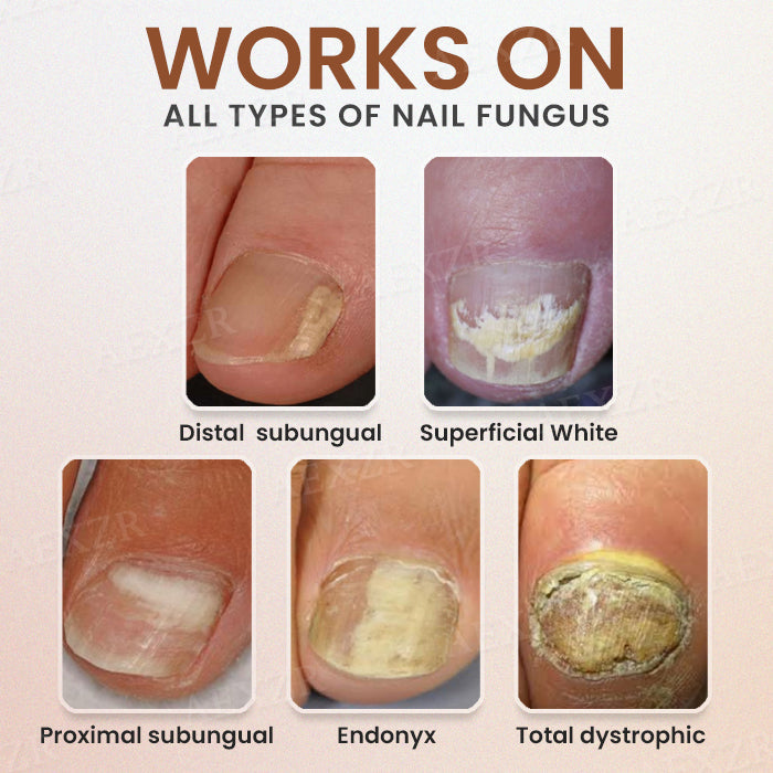 Piguiay® Nails Repairing Serum