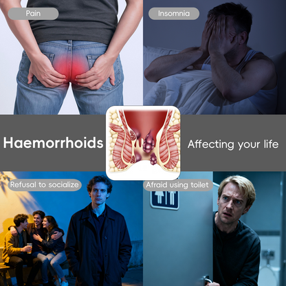 🎅𝘾𝙝𝙧𝙞𝙨𝙩𝙢𝙖𝙨 𝙎𝙖𝙡𝙚🎁 Cvreoz® Fast Hemorrhoid PRO Spray