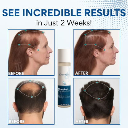 Cvreoz® NeuroRoot Reset Roll-On Serum