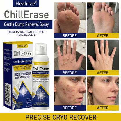 ❄️𝙎𝙥𝙚𝙘𝙞𝙖𝙡 𝙋𝙧𝙤𝙢𝙤𝙩𝙞𝙤𝙣  | Healrize®ChillErase Gentle Bump Renewal Spray ❄️