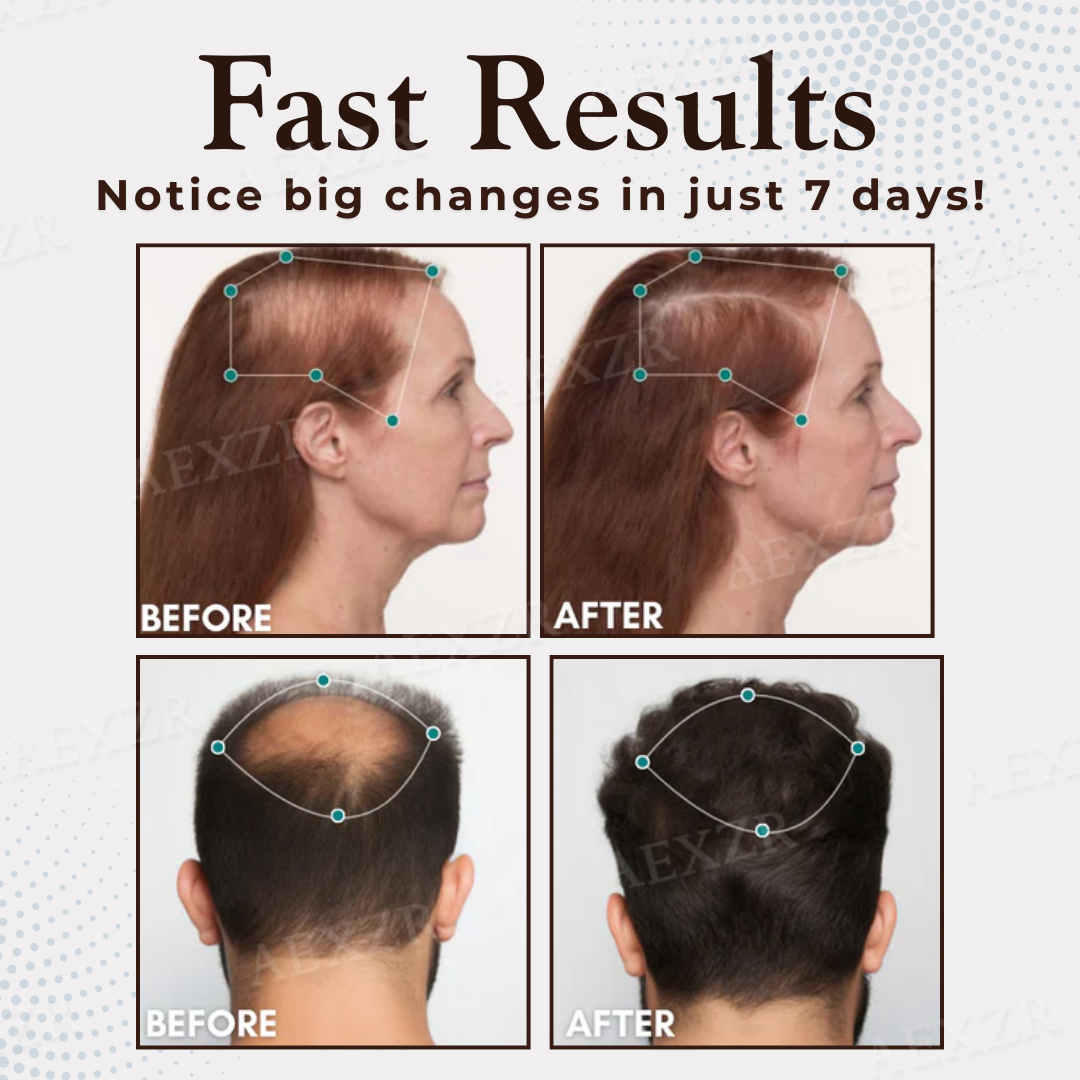 Cvreoz® Hair Regrowth Capsules