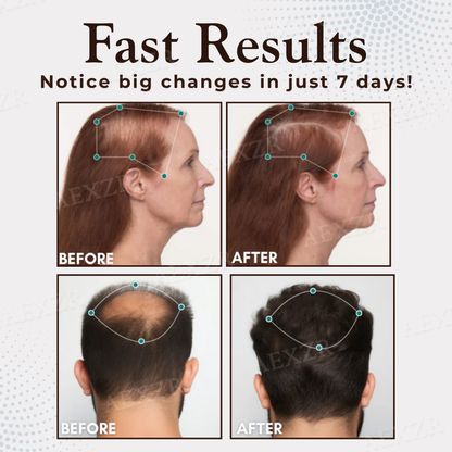 Cvreoz® Hair Regrowth Capsules
