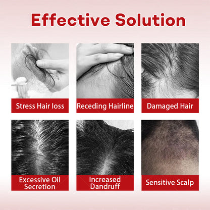 Cvreoz® Hair Regrowth System