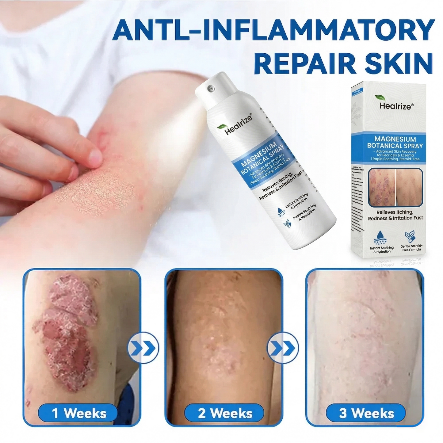 🔥Healrize® Magnesium Botanical Spray – Advanced Skin Recovery for Psoriasis & Eczema | Rapid Soothing, Steroid-Free