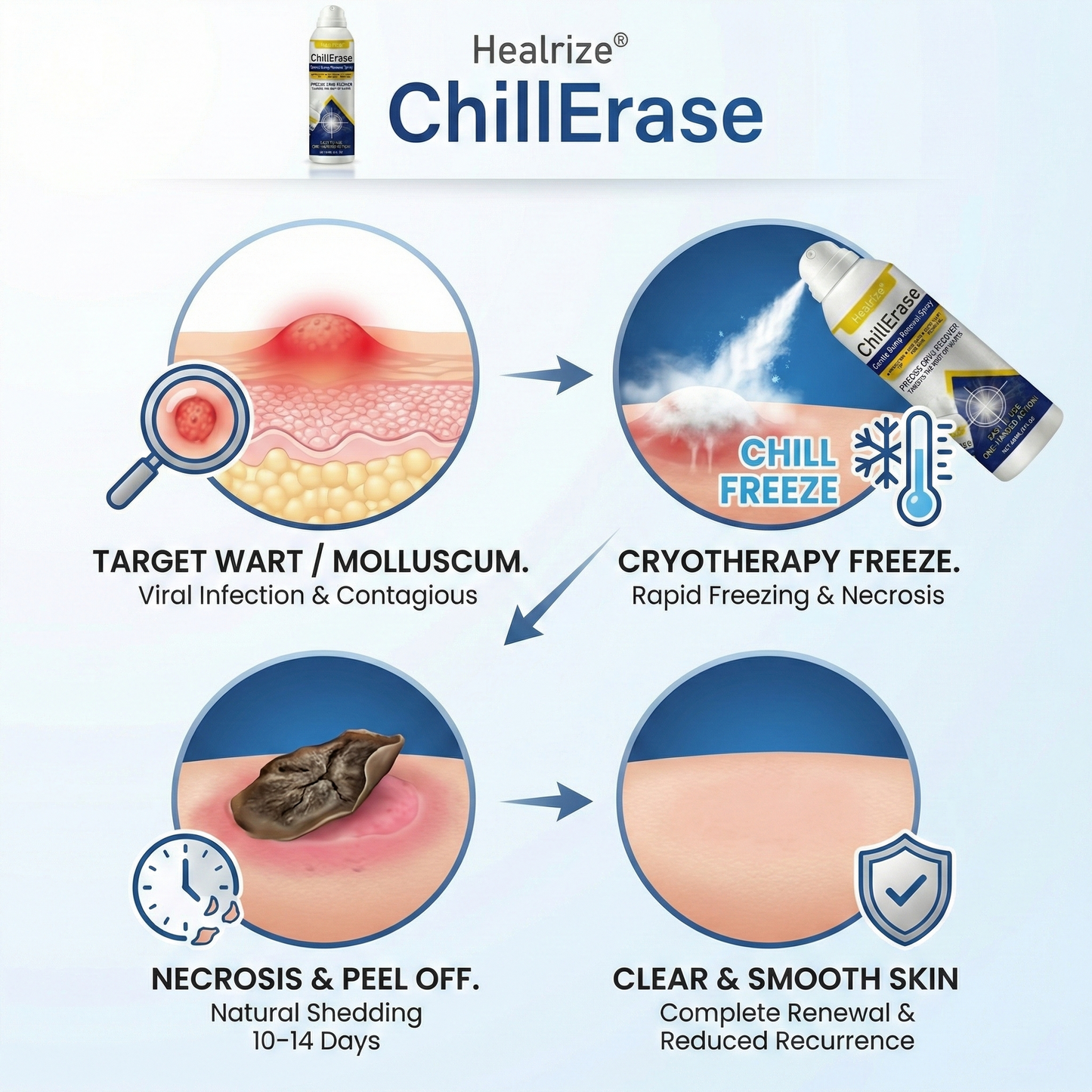 ❄️𝙎𝙥𝙚𝙘𝙞𝙖𝙡 𝙋𝙧𝙤𝙢𝙤𝙩𝙞𝙤𝙣  | Healrize®ChillErase Gentle Bump Renewal Spray ❄️
