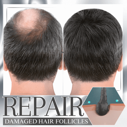 Dobshow Anti-Shedding Hair Spray