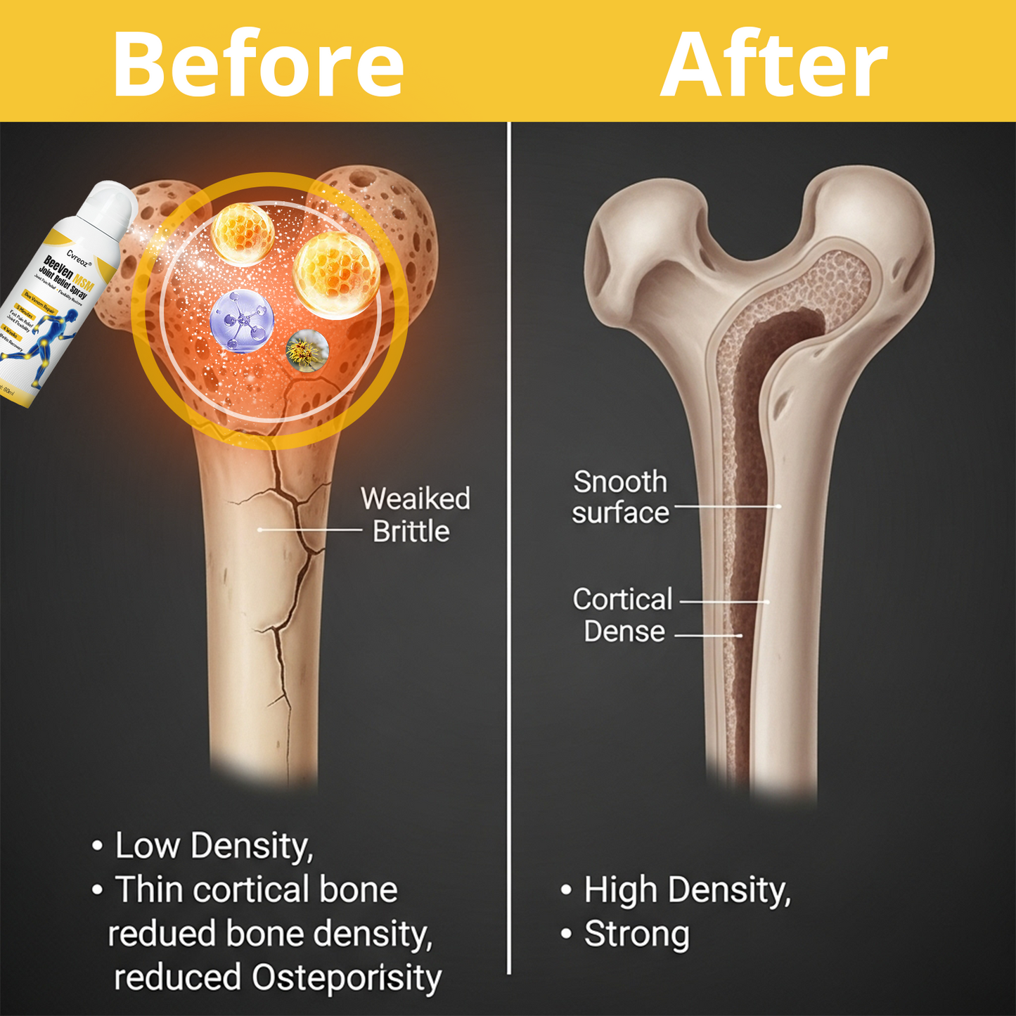 Cvreoz®  MSM BeeVen Joint Relief Spray