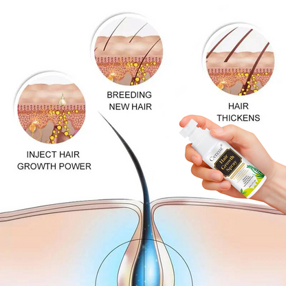 ⓒⓥⓡⓔⓞⓩ® Nourish & Flourish Hair Growth Spray + 5%Minoxidil