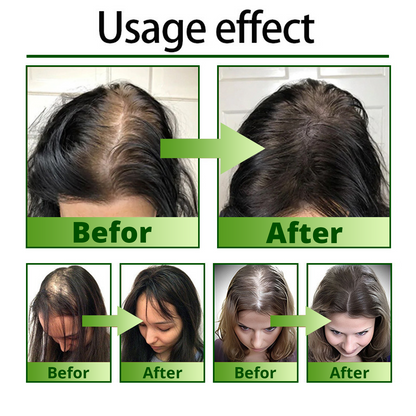 ⓒⓥⓡⓔⓞⓩ® Nourish & Flourish Hair Growth Spray