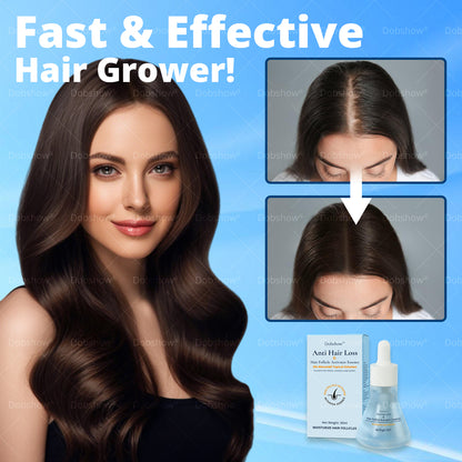 Ⓓⓞⓑⓢⓗⓞⓦ ® Anti Hair Loss & Hair Follicle Activator Essence