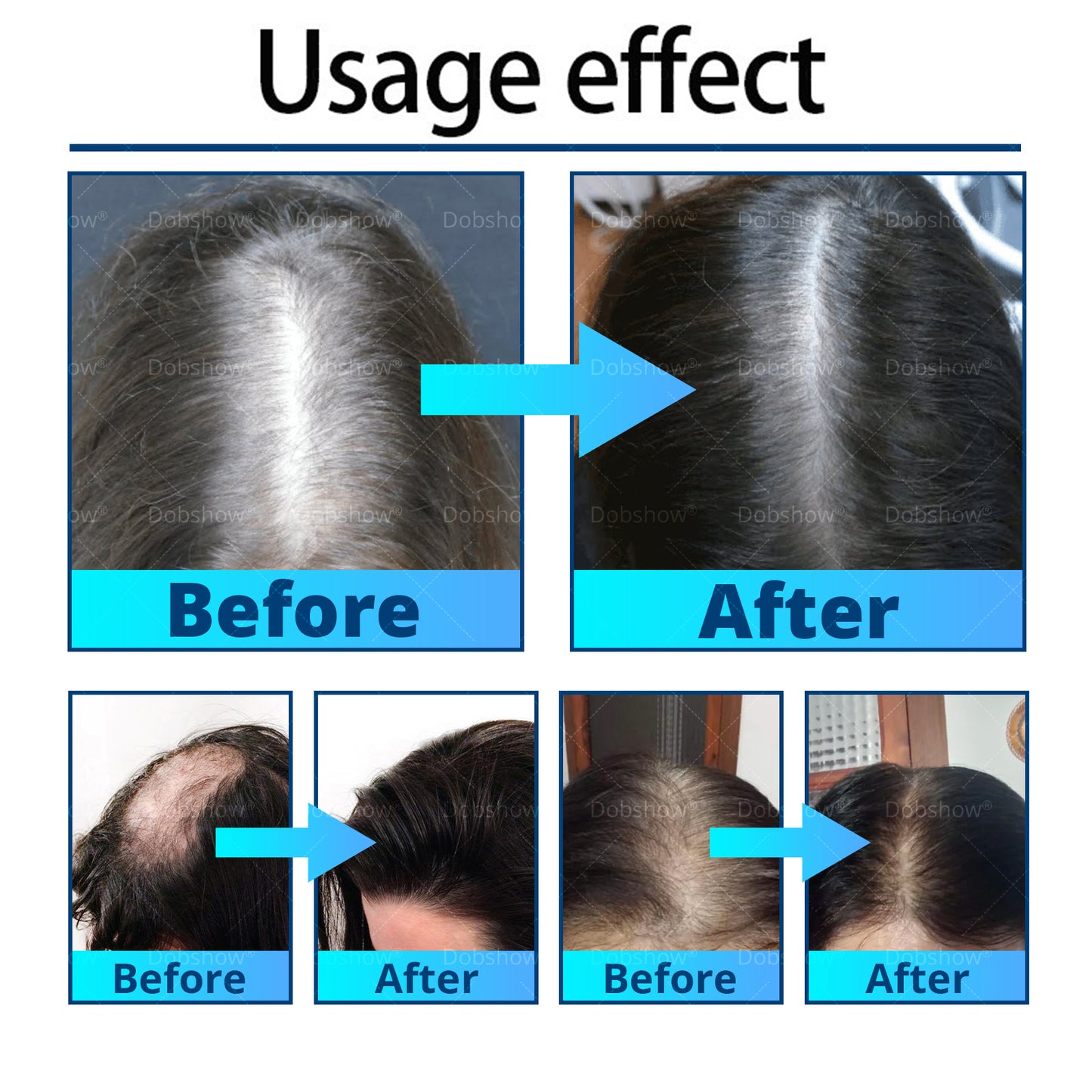 Ⓓⓞⓑⓢⓗⓞⓦ ® Anti Hair Loss & Hair Follicle Activator Essence