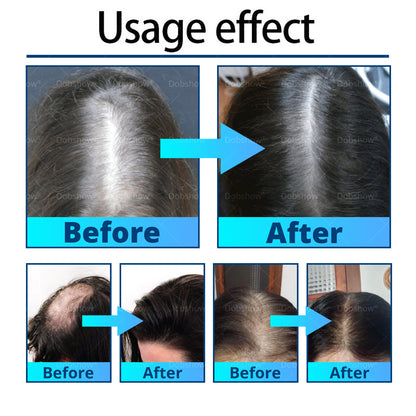 Ⓓⓞⓑⓢⓗⓞⓦ ® Anti Hair Loss & Hair Follicle Activator Essence
