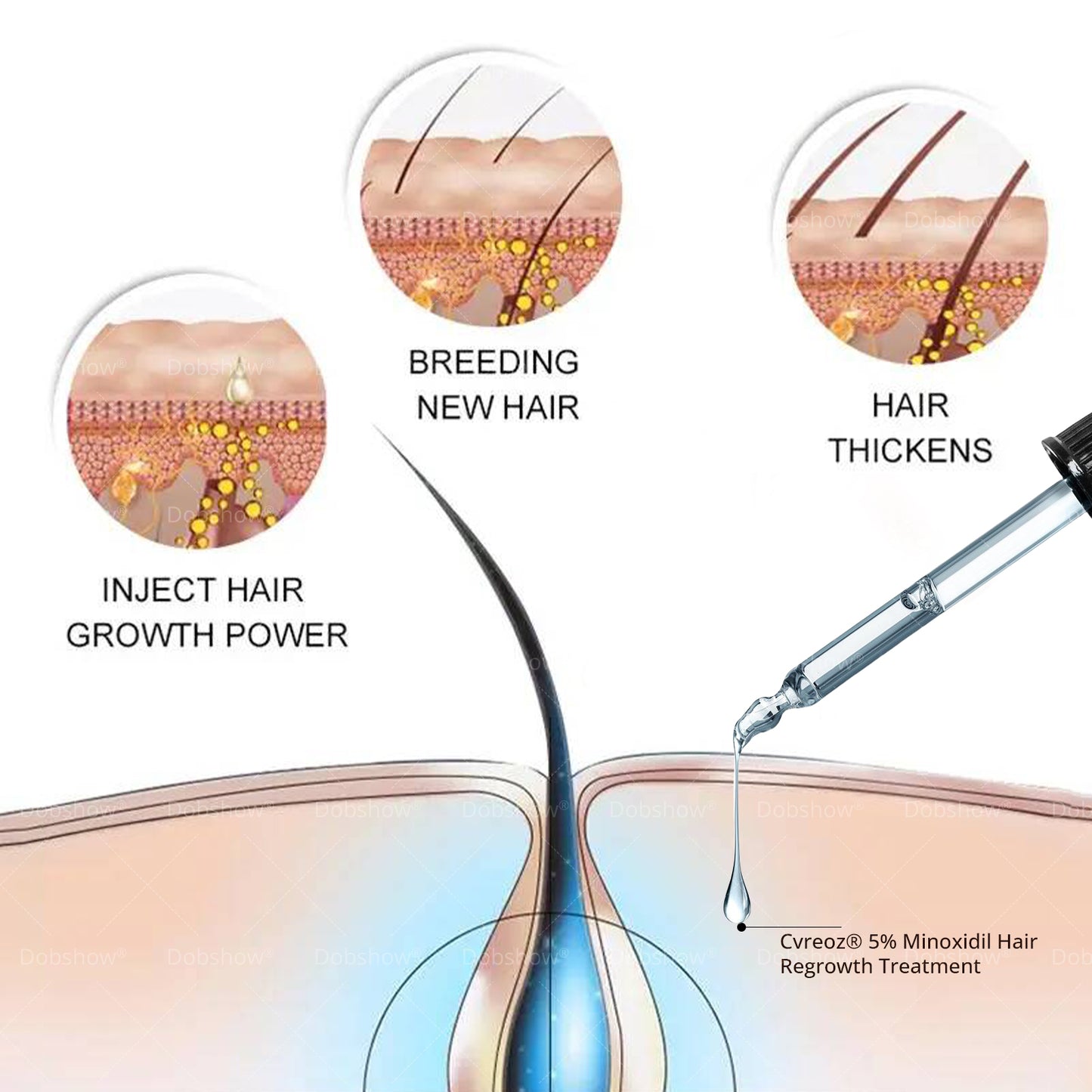 ⓒⓥⓡⓔⓞⓩ® 5% Minoxidil Hair Pro-growth Treatment