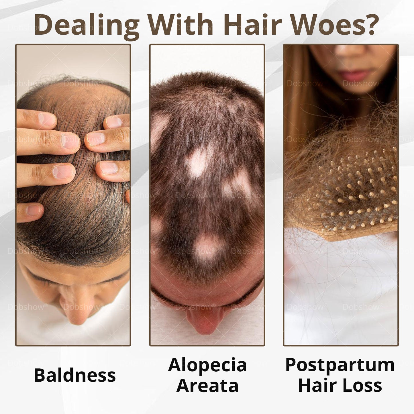 ⓒⓥⓡⓔⓞⓩ® 5% Minoxidil Hair Pro-growth Treatment