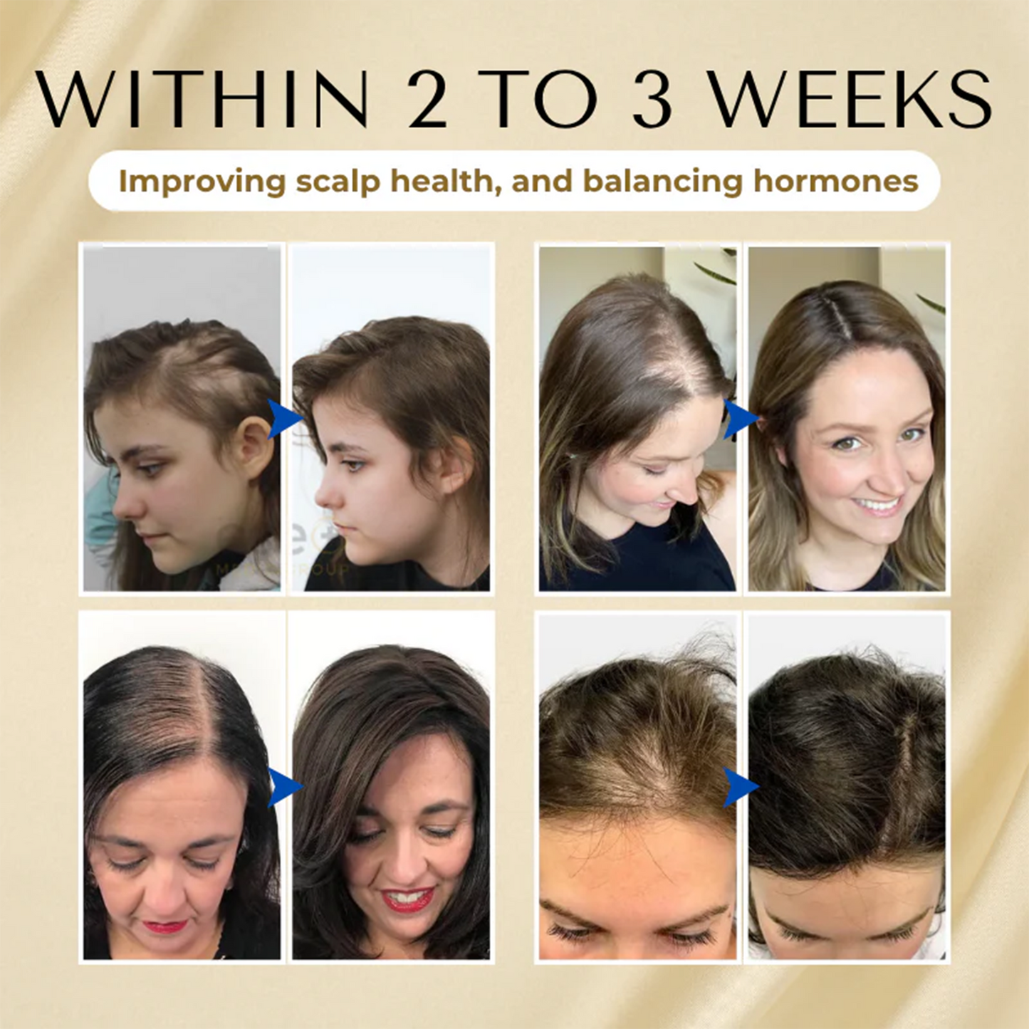 Cvreoz® Biotin Hair Essential Oil!