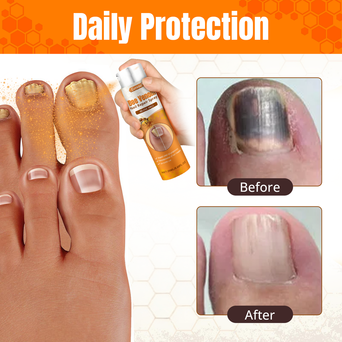 Cvreoz® Bee Venom Nail Repair Spray-Fast Relief for Fungal & Damaged Nails🌿