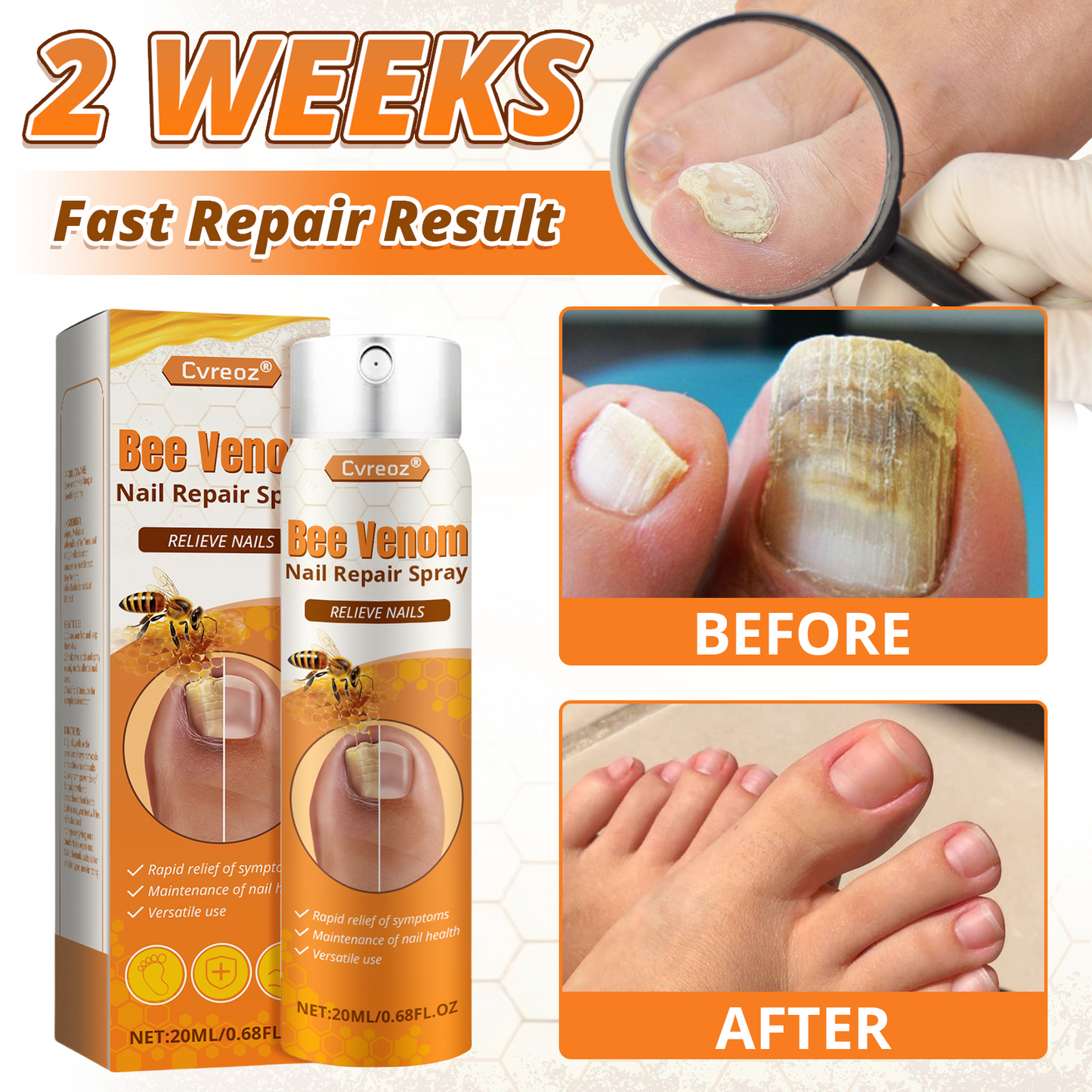 Cvreoz® Bee Venom Nail Repair Spray-Fast Relief for Fungal & Damaged Nails🌿