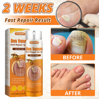 Cvreoz® Bee Venom Nail Repair Spray-Fast Relief for Fungal & Damaged Nails🌿