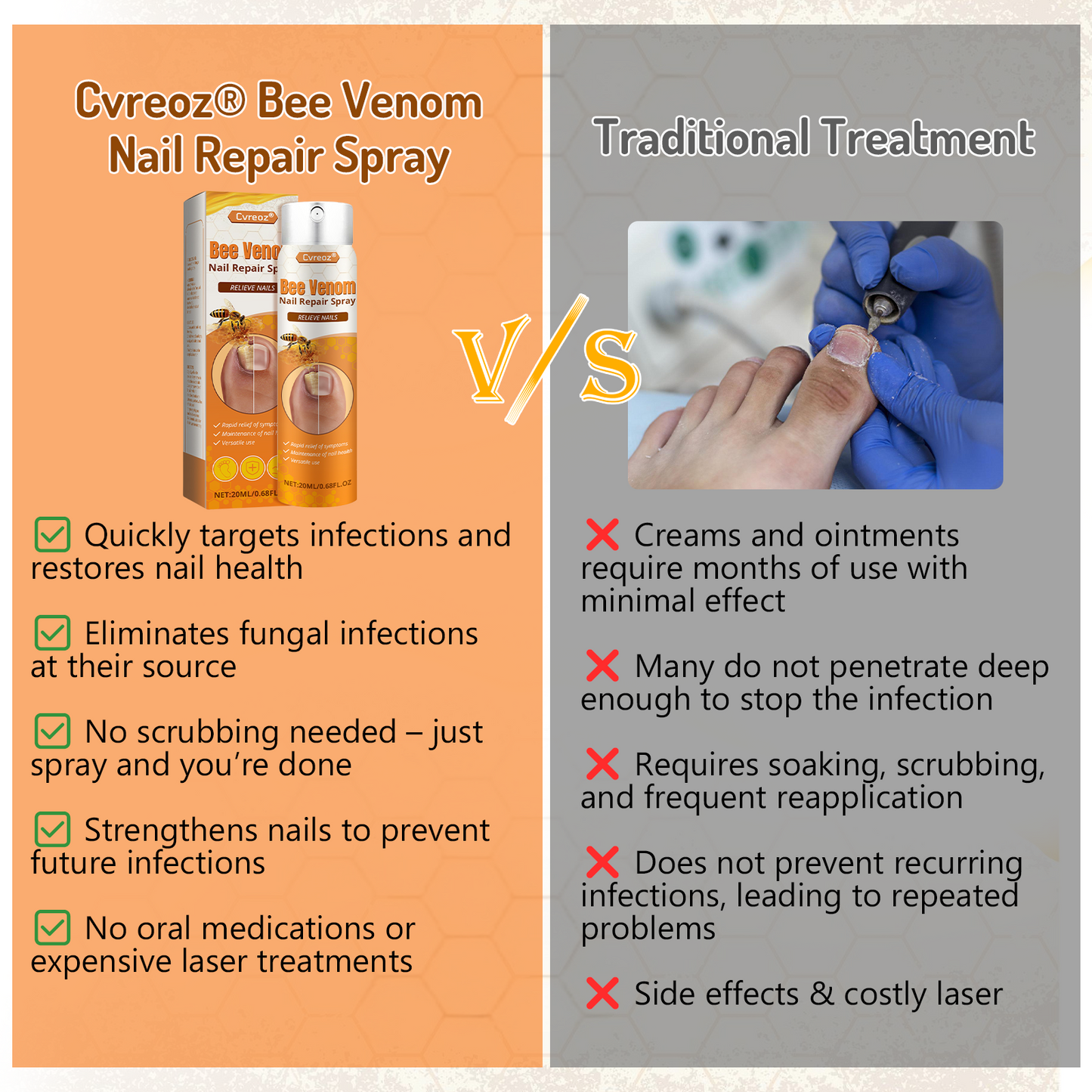 Cvreoz® Bee Venom Nail Repair Spray-Fast Relief for Fungal & Damaged Nails🌿