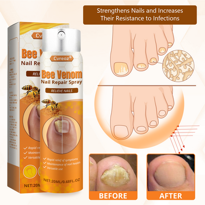 Cvreoz® Bee Venom Nail Repair Spray-Fast Relief for Fungal & Damaged Nails🌿