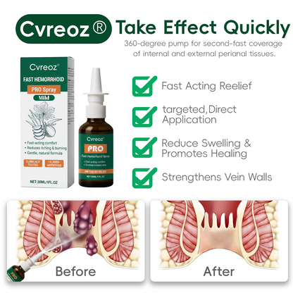 Cvreoz® Fast Hemorrhoid PRO Spray
