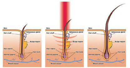 Nurbini® Home Medical Hair Growth Device