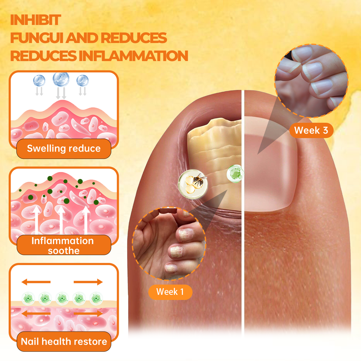 Cvreoz® Nail Renewal Spray with nano-micro needles in combination with bee venom🐝 to fight even the most stubborn fungi👊🏻